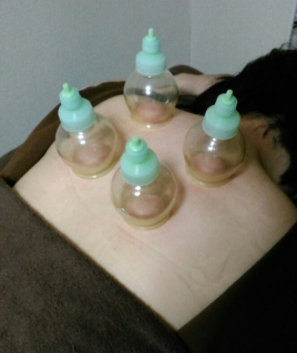 メニュー：カッピング イメージ